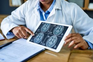 Doctor showing brain scan on digital tablet