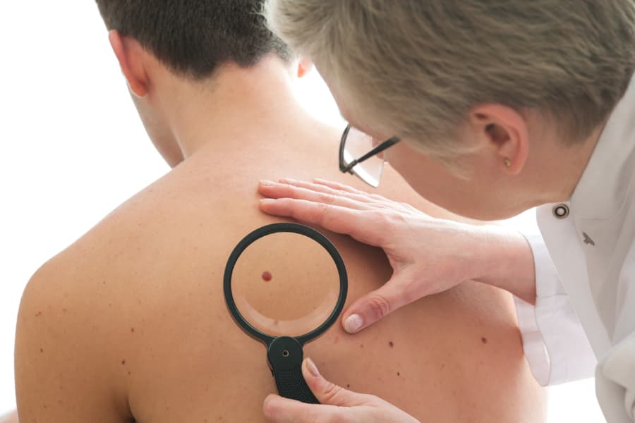 Skin cancer specialist examining patient’s back for signs