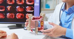 Doctor using medical model to explain colon biopsy in front of colonoscopy images