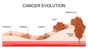 Medical concept image of cancer development and spread