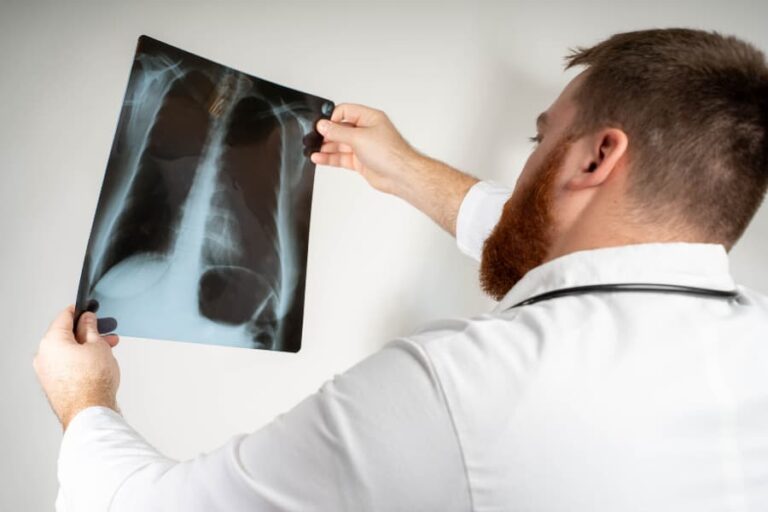 Squamous Cell Carcinoma Lung Cancer Treatment in NJ, CT, & MA