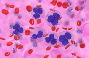Illustration of follicular lymphoma cells in blood flow