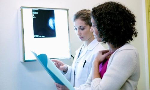 Cancer care team looking at files in front of X-ray