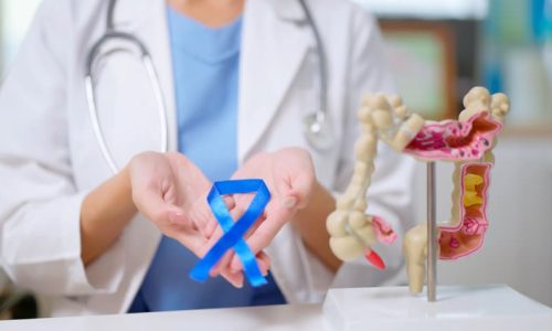 Close-up of doctor’s hand holding blue ribbon with colon model on table