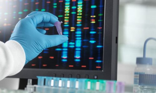 Gloved hand of doctor holding up sample next to screen with biomarker testing