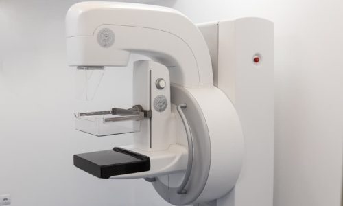 Mammogram screening device in modern clinic