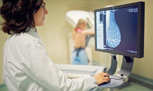 routine-screening-helps-doctors-monitor-changes-in-patient-s-breast-tissue Routine screening helps doctors monitor changes in patient’s breast tissue